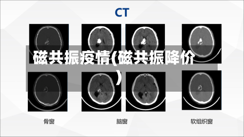 磁共振疫情(磁共振降价)-第1张图片