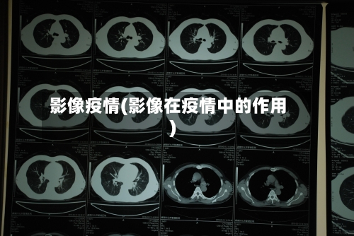 影像疫情(影像在疫情中的作用)-第1张图片