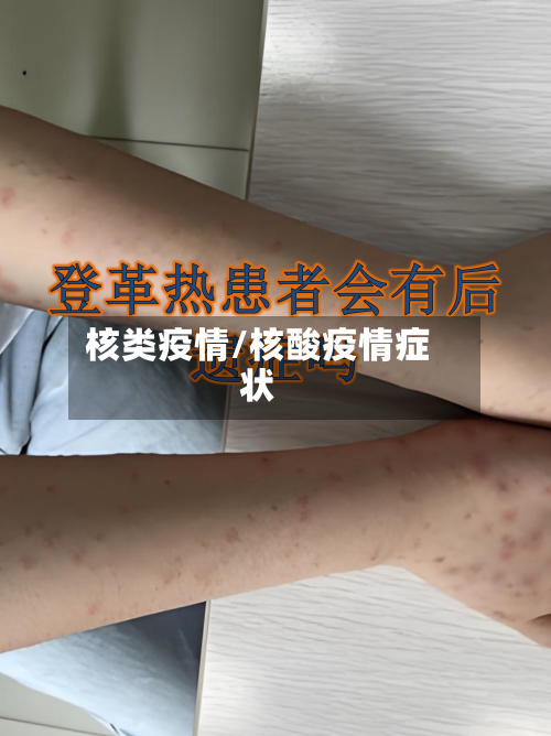 核类疫情/核酸疫情症状-第2张图片