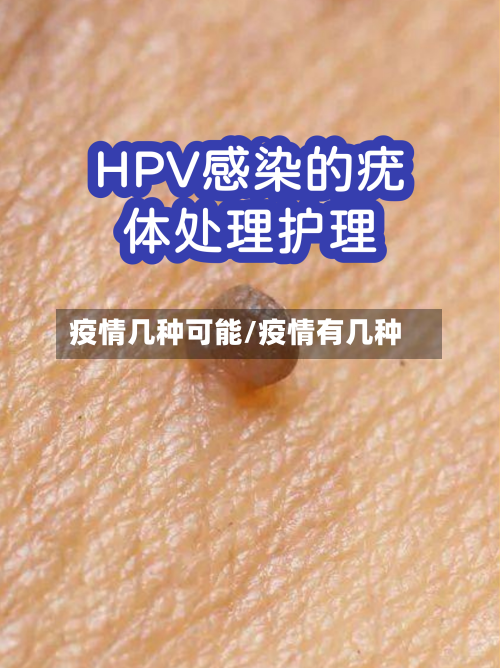 疫情几种可能/疫情有几种-第3张图片